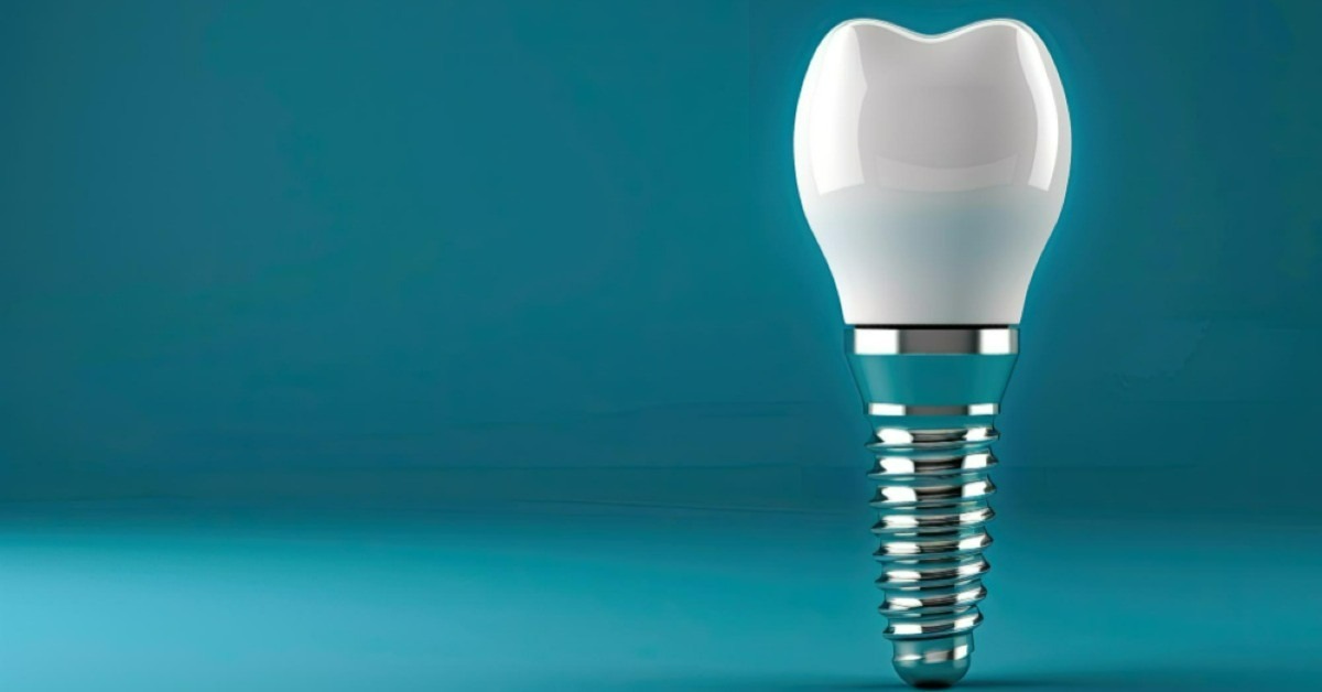 How do implants differ from other tooth replacements?